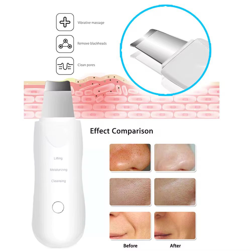 Electric blackhead pore remover