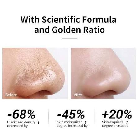 Lanbena Nose Pore Strips